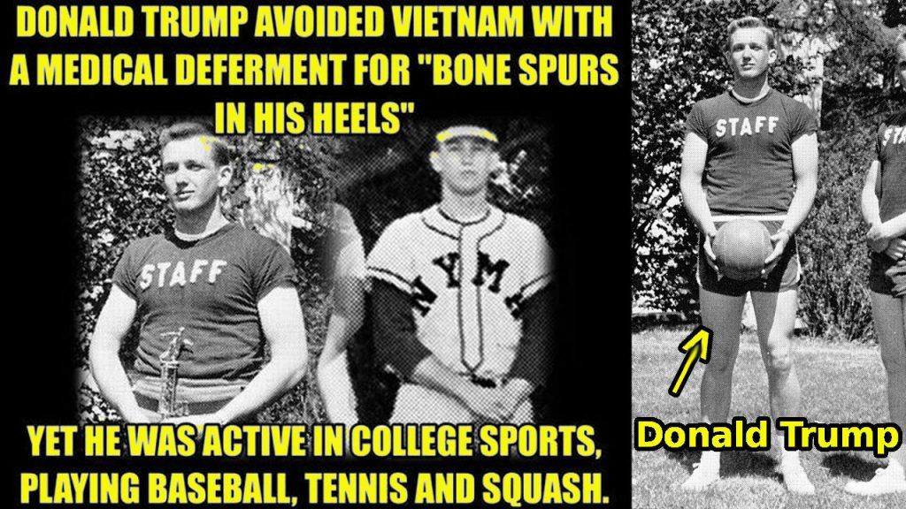 Donald Trump avoided service In Vietnam For bone spurs, but played many sports in school.